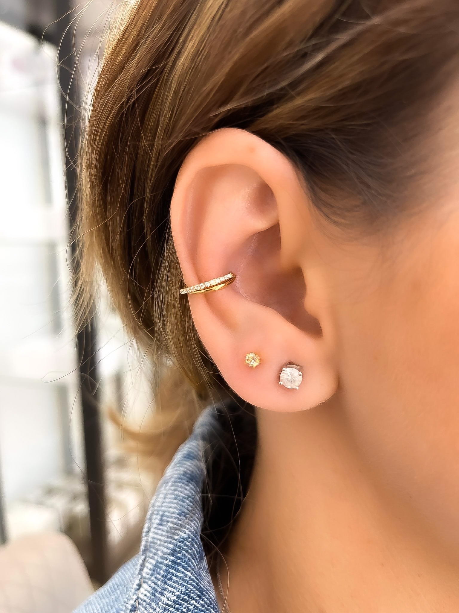 Orbital conch Clearance